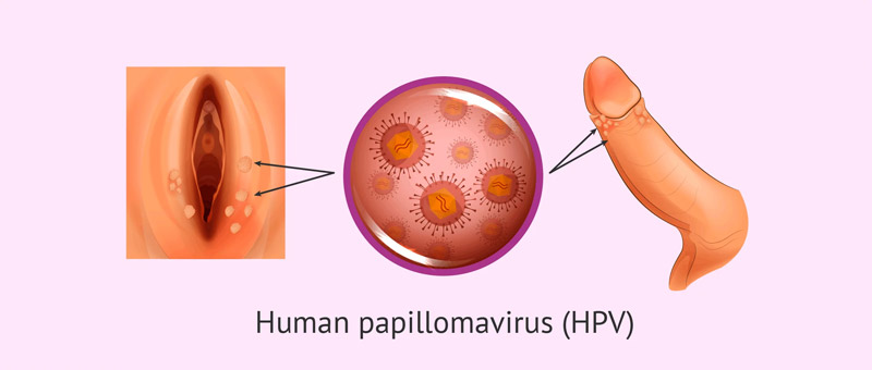 HPV in Men and Women
