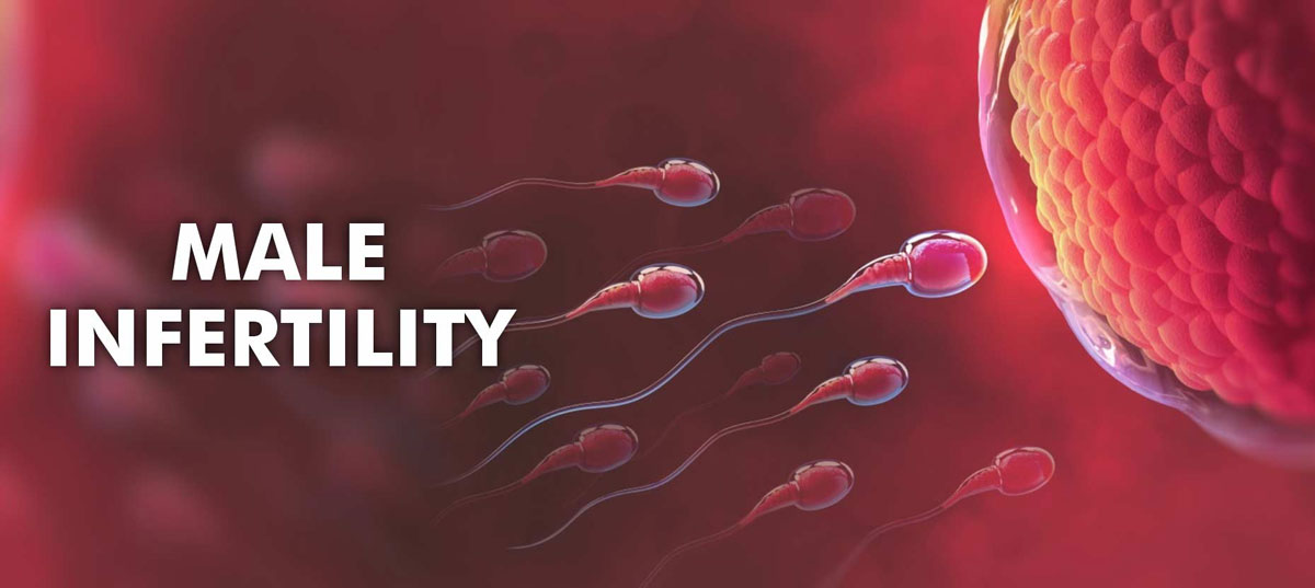 Male Infertility