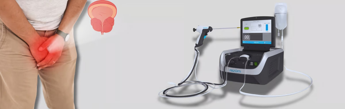 Rezum Prostate