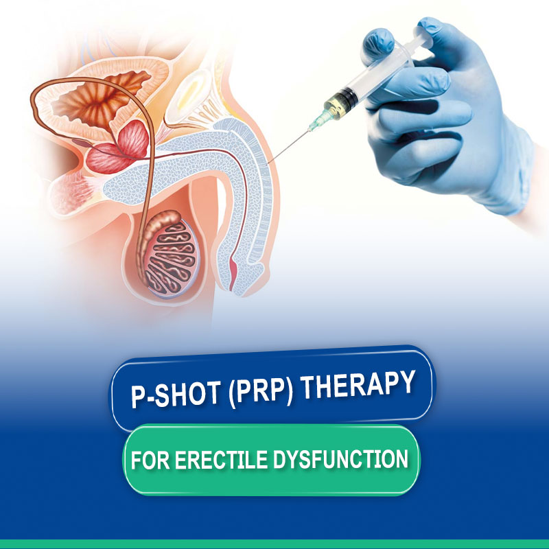 P-Shot Therapy for Erectile Dysfunction