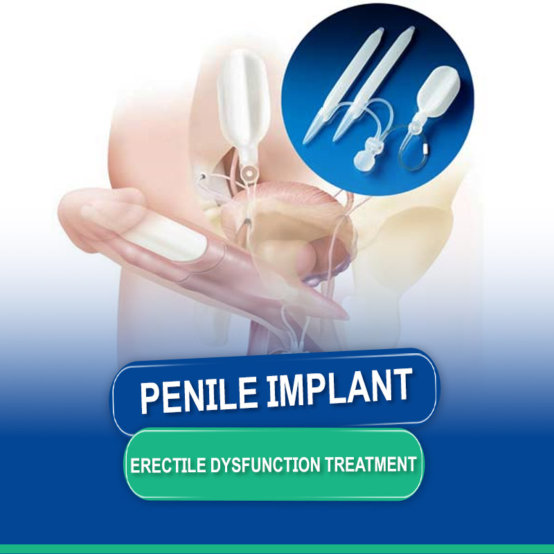 Penile Implant or Prosthesis - Erectile dysfunction (ED) Treatment