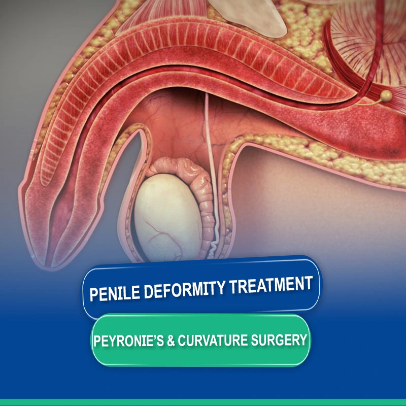 Penile Deformity Treatment