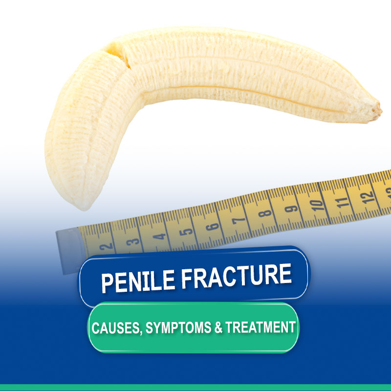 Penile Fracture