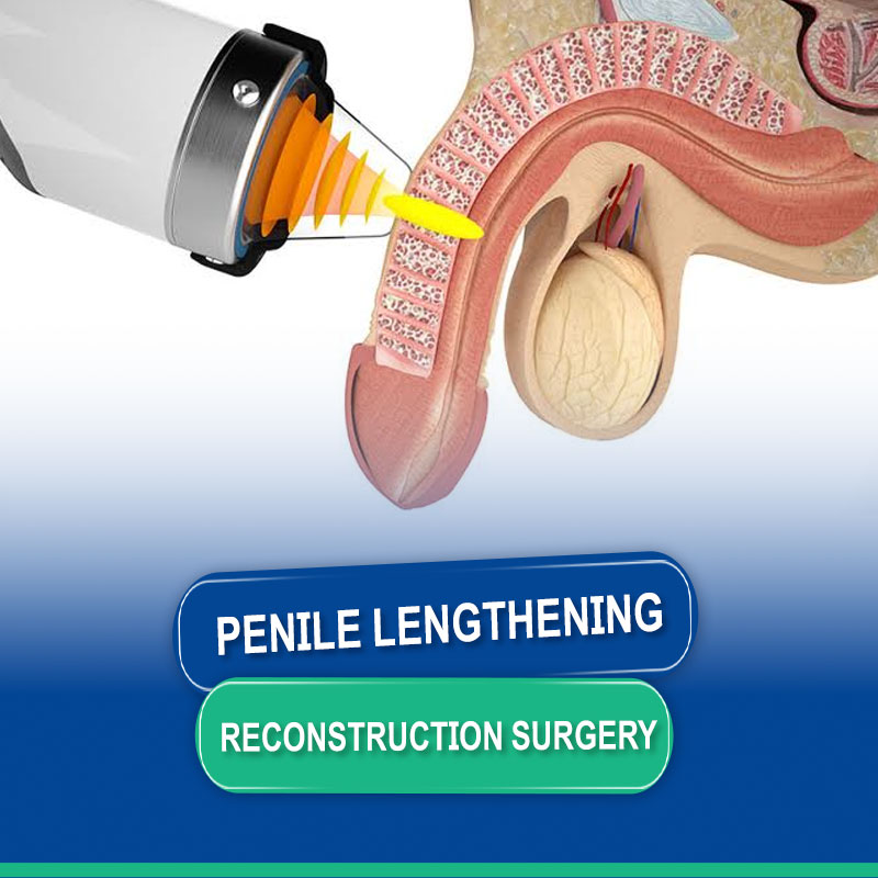 Penile Lengthening and Reconstruction Surgery