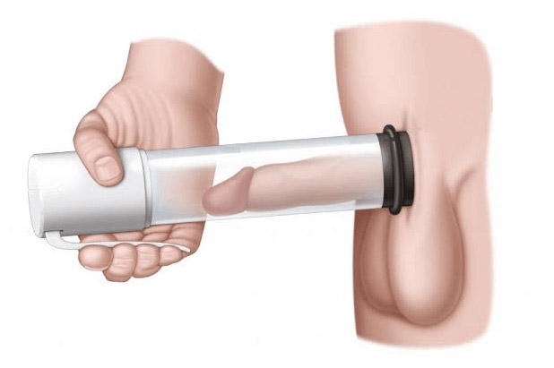 Vacuum Devices